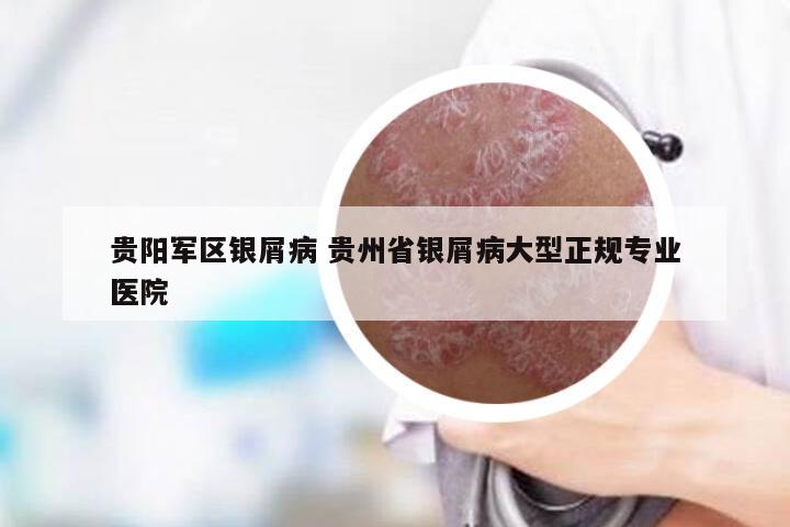 贵阳军区银屑病 贵州省银屑病大型正规专业医院