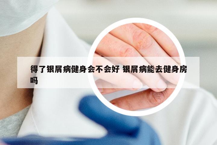 得了银屑病健身会不会好 银屑病能去健身房吗