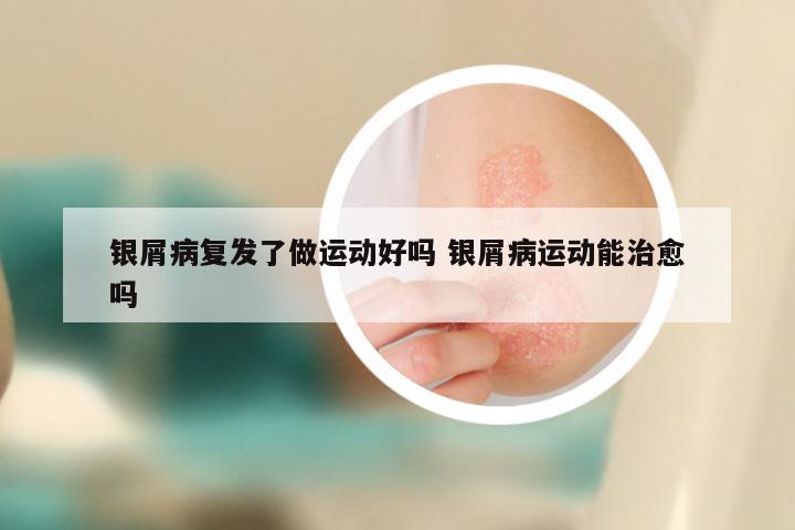 银屑病复发了做运动好吗 银屑病运动能治愈吗