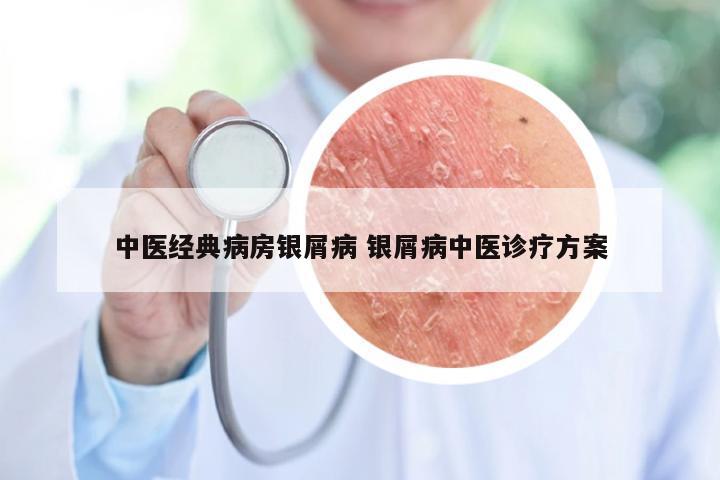 中医经典病房银屑病 银屑病中医诊疗方案