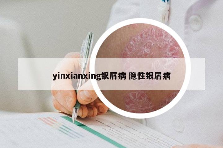 yinxianxing银屑病 隐性银屑病