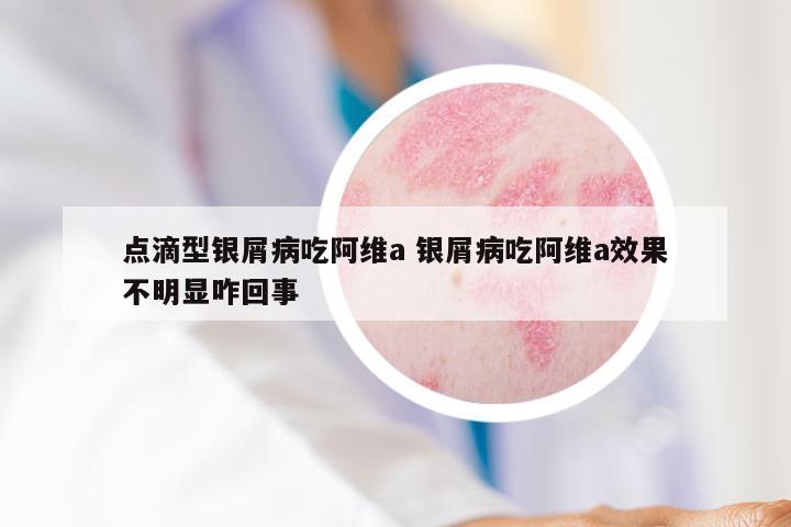 点滴型银屑病吃阿维a 银屑病吃阿维a效果不明显咋回事