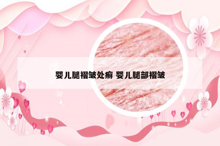 婴儿腿褶皱处癣 婴儿腿部褶皱