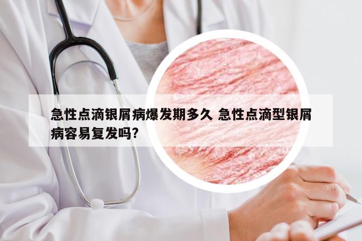 急性点滴银屑病爆发期多久 急性点滴型银屑病容易复发吗?