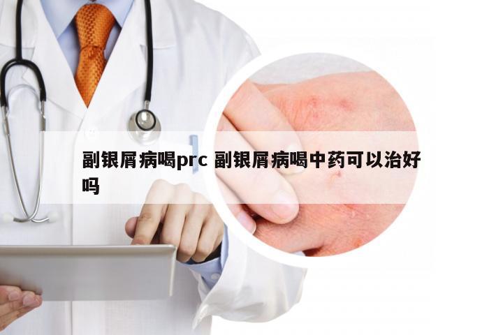 副银屑病喝prc 副银屑病喝中药可以治好吗