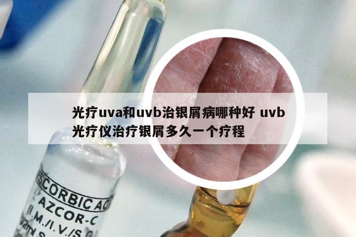 光疗uva和uvb治银屑病哪种好 uvb光疗仪治疗银屑多久一个疗程