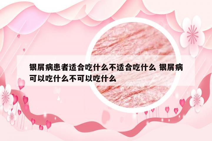 银屑病患者适合吃什么不适合吃什么 银屑病可以吃什么不可以吃什么