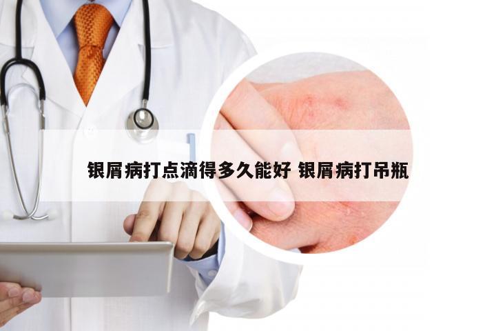 银屑病打点滴得多久能好 银屑病打吊瓶