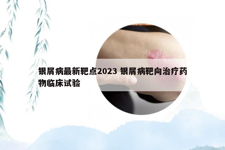 银屑病最新靶点2023 银屑病靶向治疗药物临床试验