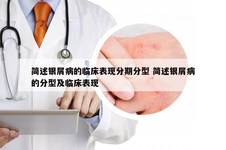 简述银屑病的临床表现分期分型 简述银屑病的分型及临床表现