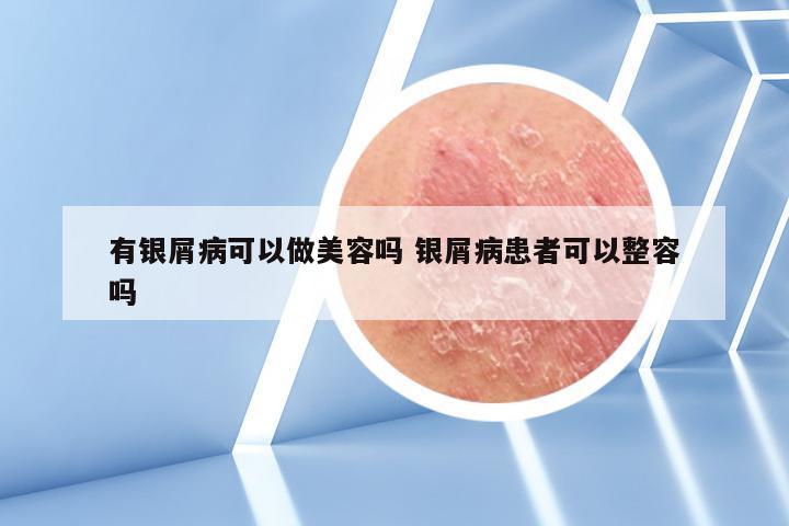 有银屑病可以做美容吗 银屑病患者可以整容吗