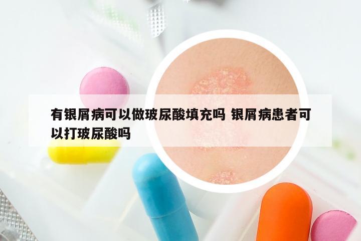 有银屑病可以做玻尿酸填充吗 银屑病患者可以打玻尿酸吗