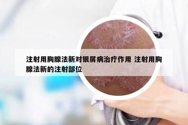 注射用胸腺法新对银屑病治疗作用 注射用胸腺法新的注射部位