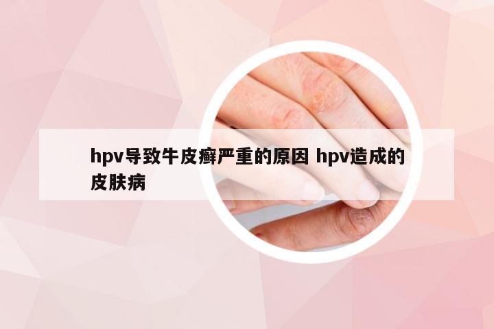 hpv导致牛皮癣严重的原因 hpv造成的皮肤病