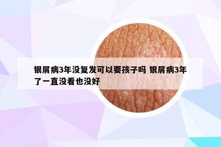 银屑病3年没复发可以要孩子吗 银屑病3年了一直没看也没好