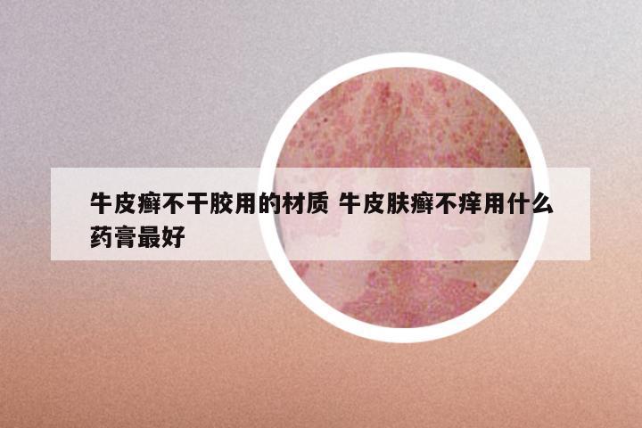 牛皮癣不干胶用的材质 牛皮肤癣不痒用什么药膏最好