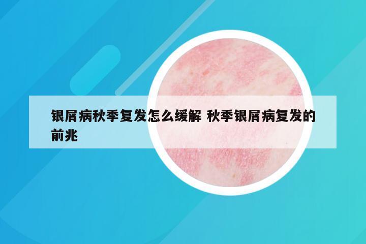 银屑病秋季复发怎么缓解 秋季银屑病复发的前兆