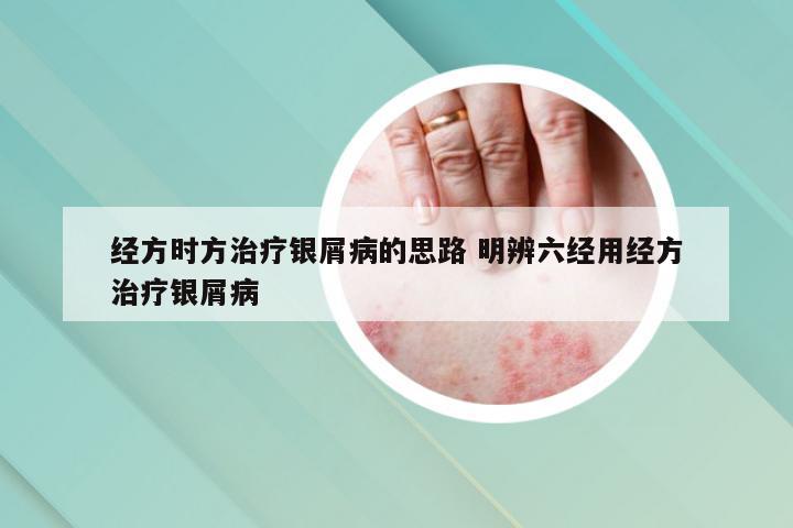 经方时方治疗银屑病的思路 明辨六经用经方治疗银屑病