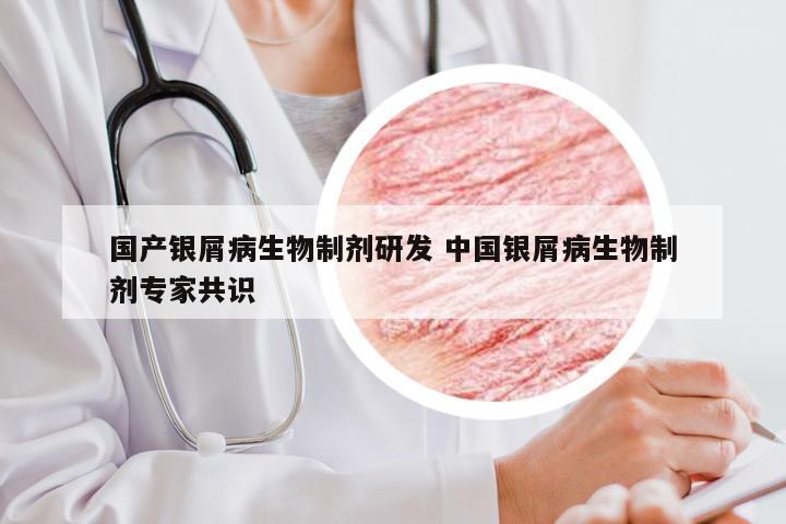 国产银屑病生物制剂研发 中国银屑病生物制剂专家共识