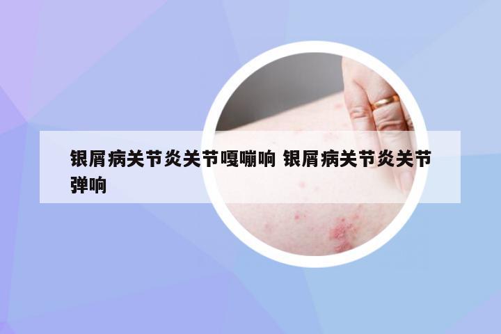 银屑病关节炎关节嘎嘣响 银屑病关节炎关节弹响