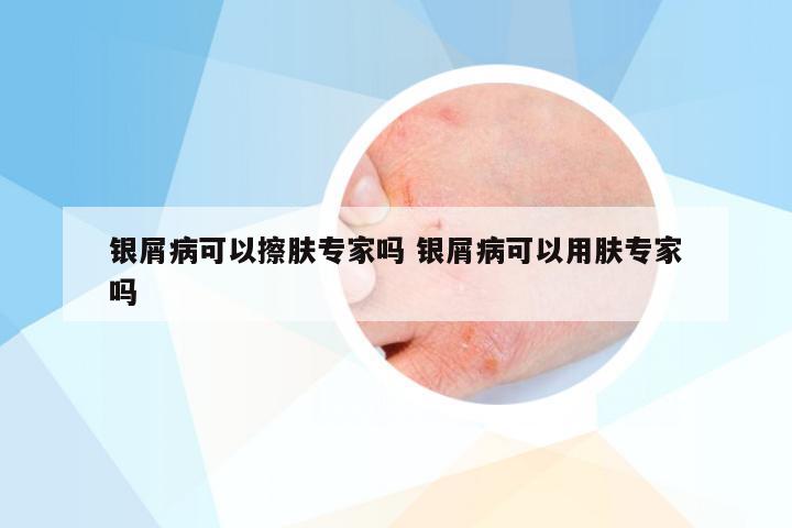 银屑病可以擦肤专家吗 银屑病可以用肤专家吗