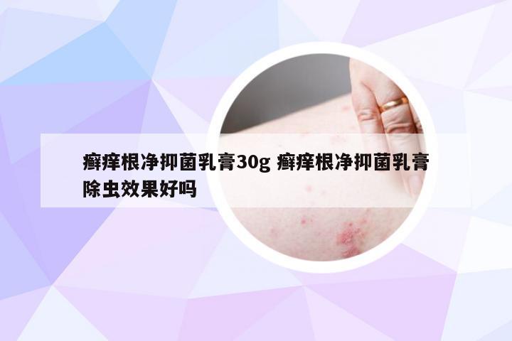 癣痒根净抑菌乳膏30g 癣痒根净抑菌乳膏除虫效果好吗