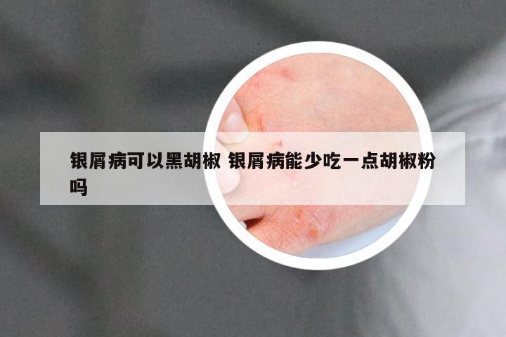 银屑病可以黑胡椒 银屑病能少吃一点胡椒粉吗