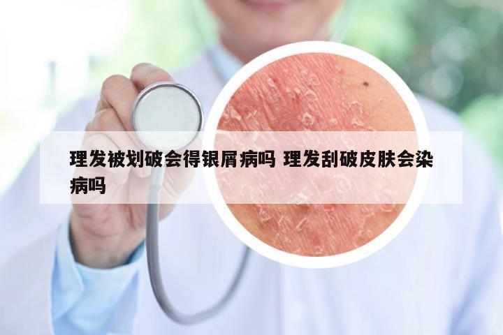 理发被划破会得银屑病吗 理发刮破皮肤会染病吗