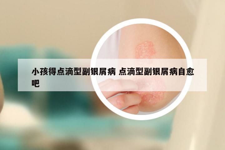 小孩得点滴型副银屑病 点滴型副银屑病自愈吧