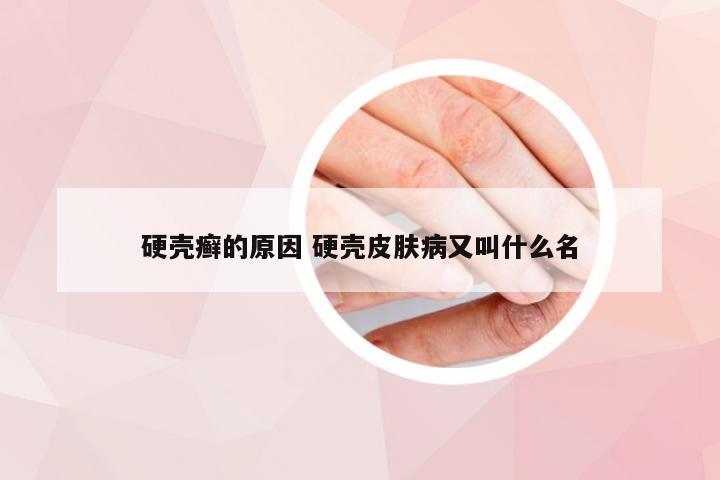 硬壳癣的原因 硬壳皮肤病又叫什么名