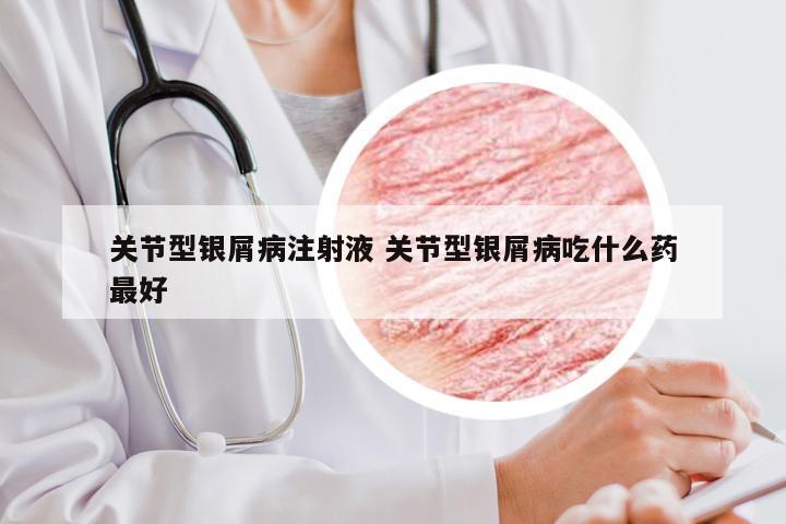 关节型银屑病注射液 关节型银屑病吃什么药最好