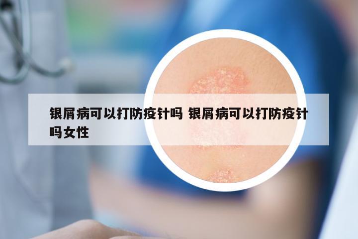 银屑病可以打防疫针吗 银屑病可以打防疫针吗女性