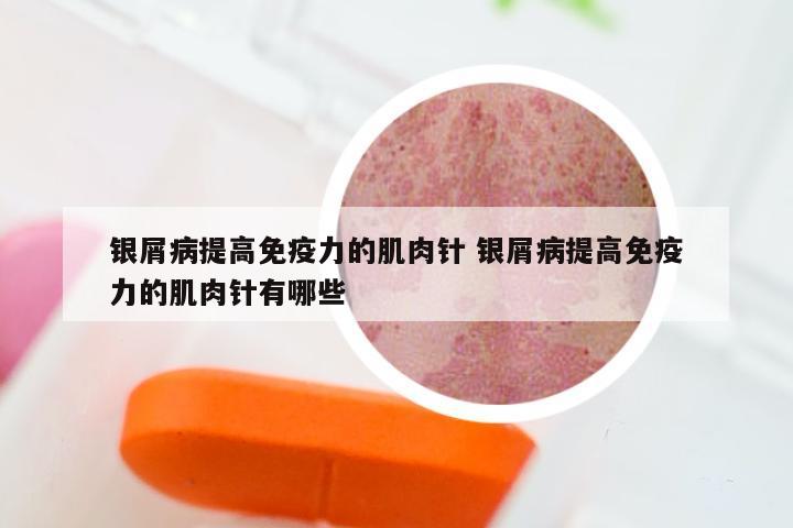 银屑病提高免疫力的肌肉针 银屑病提高免疫力的肌肉针有哪些