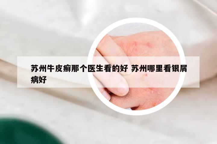 苏州牛皮癣那个医生看的好 苏州哪里看银屑病好