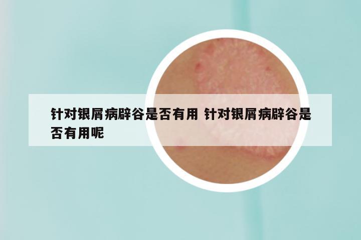 针对银屑病辟谷是否有用 针对银屑病辟谷是否有用呢