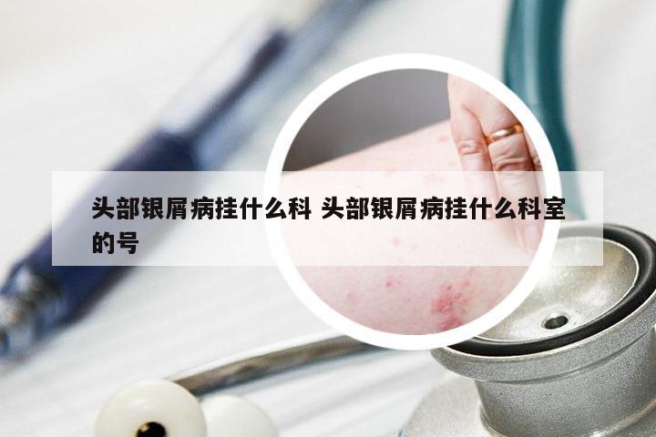 头部银屑病挂什么科 头部银屑病挂什么科室的号