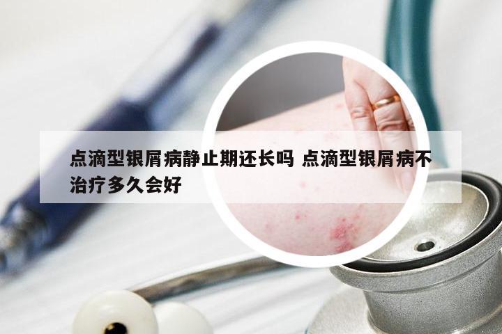 点滴型银屑病静止期还长吗 点滴型银屑病不治疗多久会好