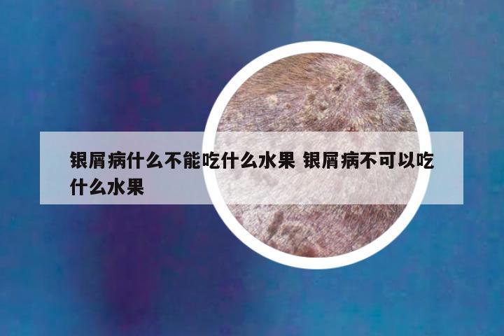 银屑病什么不能吃什么水果 银屑病不可以吃什么水果