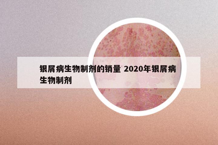 银屑病生物制剂的销量 2020年银屑病 生物制剂