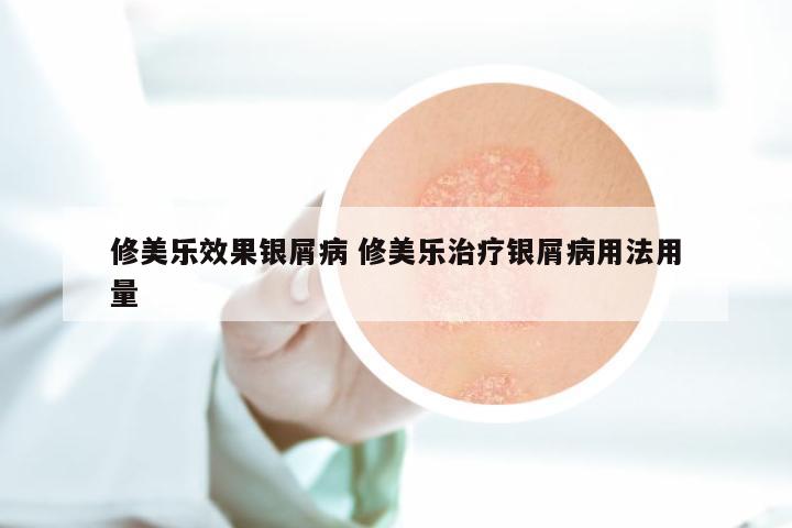 修美乐效果银屑病 修美乐治疗银屑病用法用量