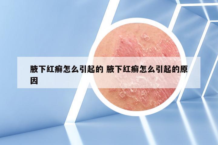 腋下红癣怎么引起的 腋下红癣怎么引起的原因