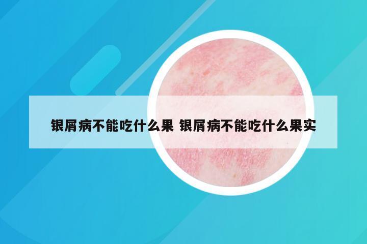 银屑病不能吃什么果 银屑病不能吃什么果实