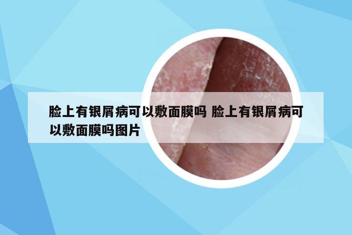 脸上有银屑病可以敷面膜吗 脸上有银屑病可以敷面膜吗图片