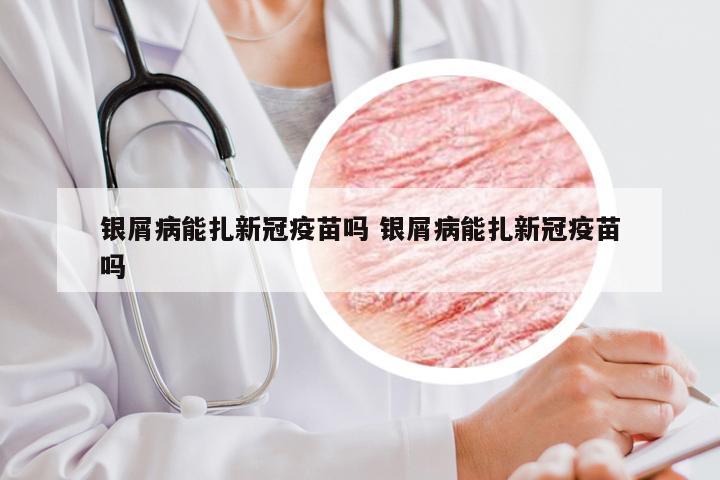 银屑病能扎新冠疫苗吗 银屑病能扎新冠疫苗吗