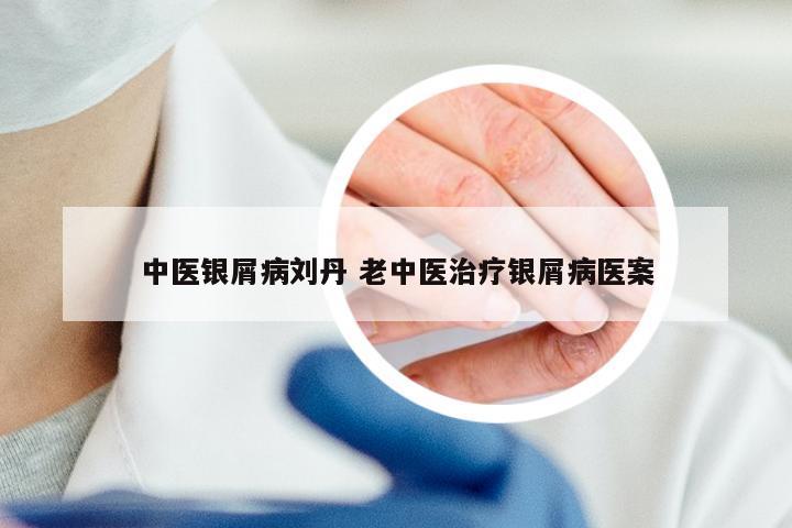 中医银屑病刘丹 老中医治疗银屑病医案