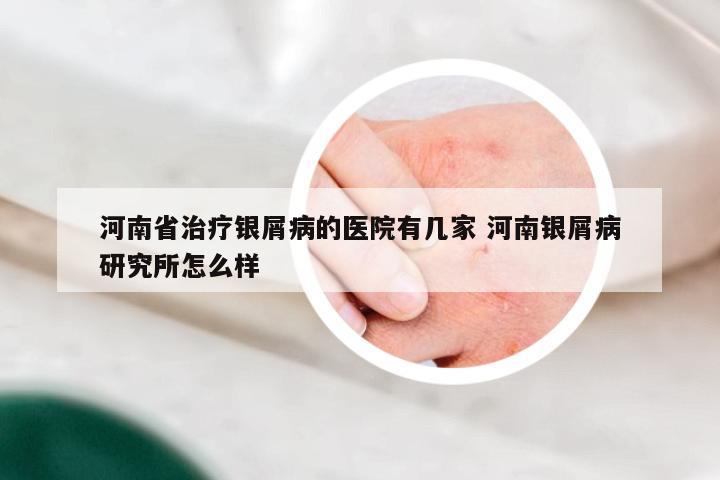 河南省治疗银屑病的医院有几家 河南银屑病研究所怎么样