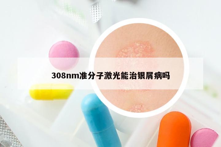 308nm准分子激光能治银屑病吗