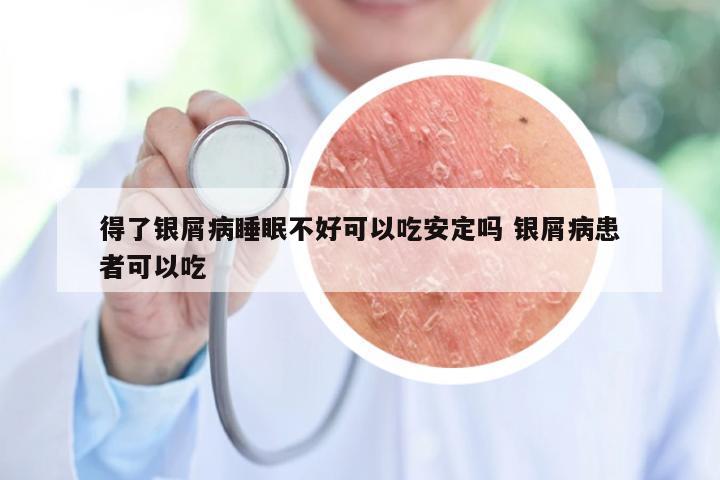 得了银屑病睡眠不好可以吃安定吗 银屑病患者可以吃