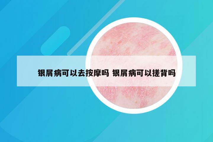 银屑病可以去按摩吗 银屑病可以搓背吗