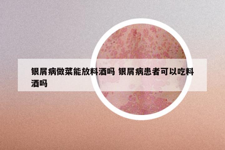 银屑病做菜能放料酒吗 银屑病患者可以吃料酒吗